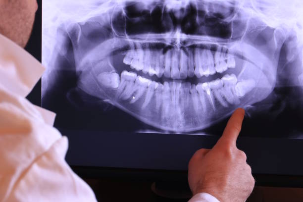 Best Emergency Dental Services for Seniors in Richwood, TX