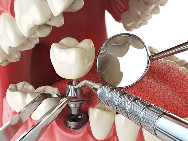 Best Mobile Emergency Dentist in Richwood, TX
